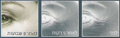 מודעה של RoC